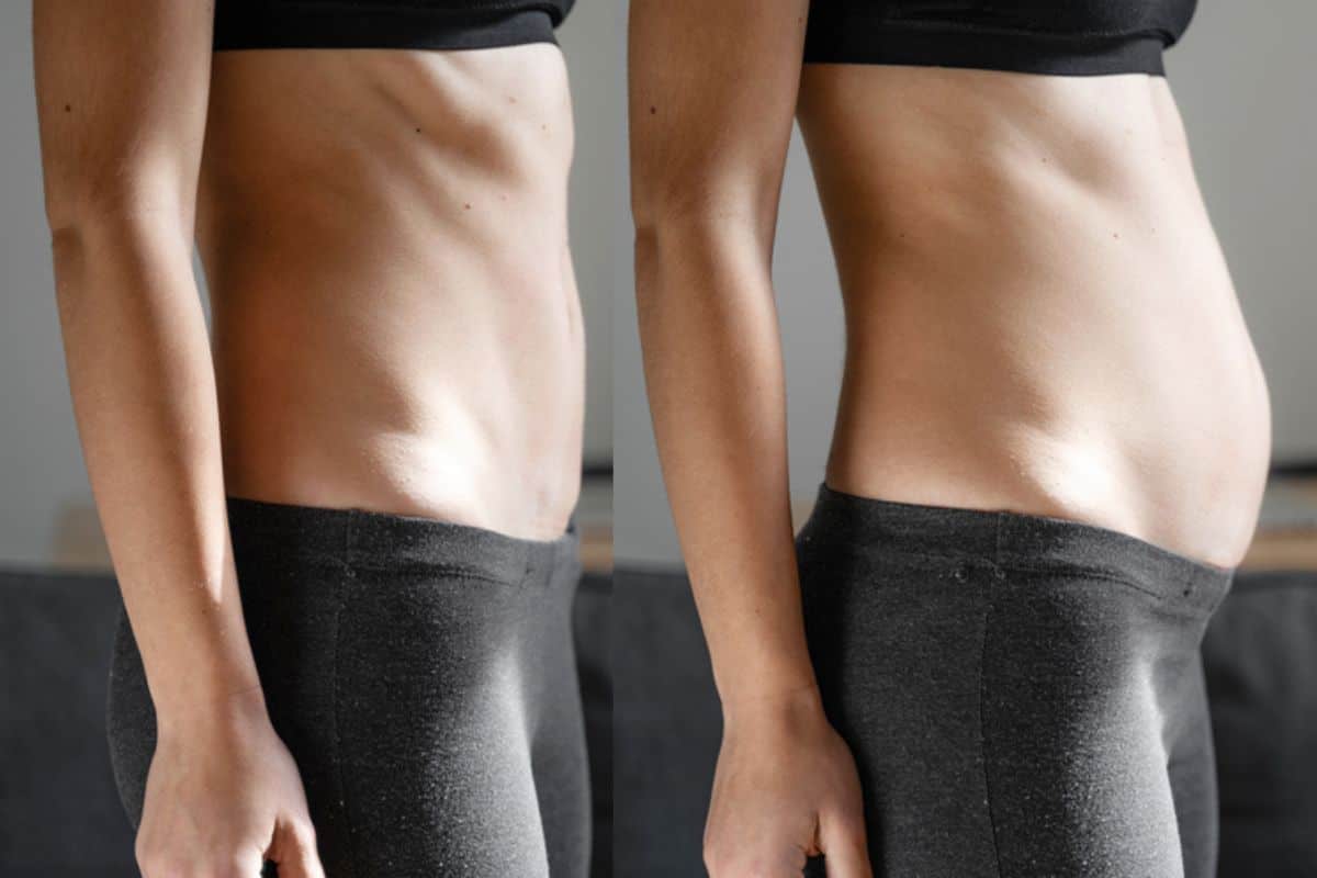 How long does diastasis recti take to improve Apsley?