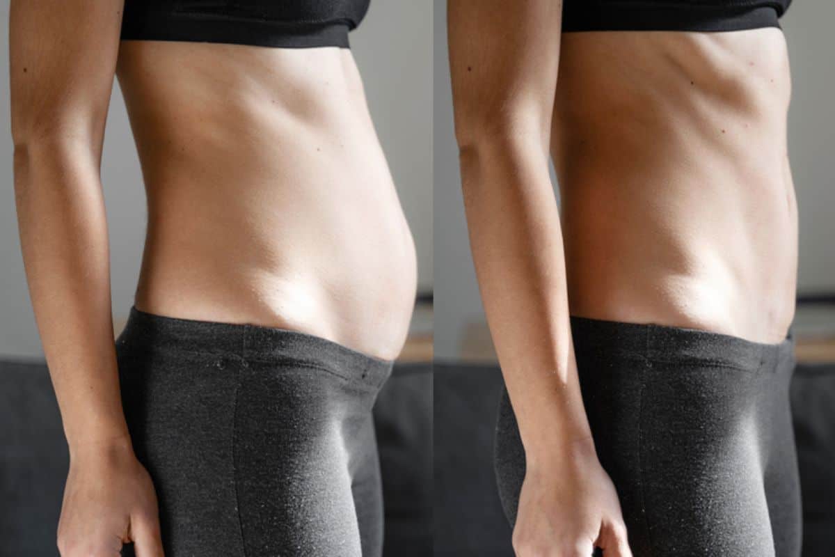 Post-Pregnancy: What Happens to Your Abdominal Muscles After Birth Apsley