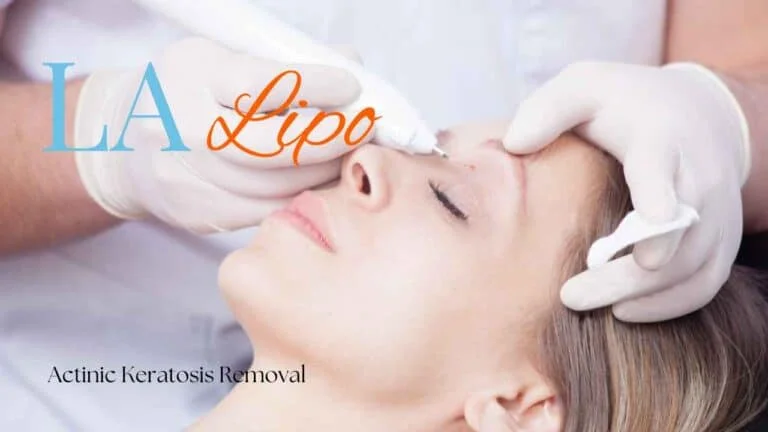 Woman receiving Actinic Keratosis Removal Treatment Apsley