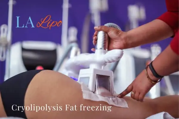 women getting fat freezing Apsley