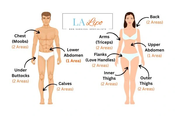 LA LIPO Cryolipolysis Areas Apsley