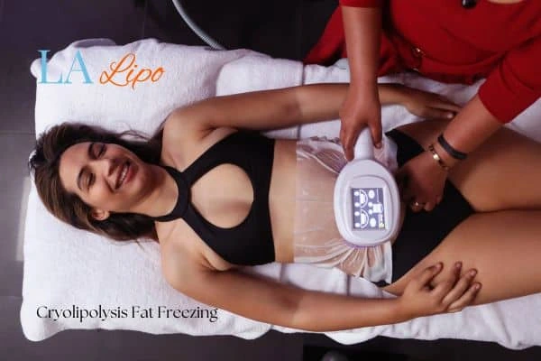 woman getting cryolipolysis Apsley