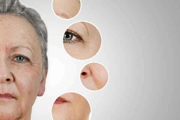 HIFU Facelift Apsley from LA LIPO