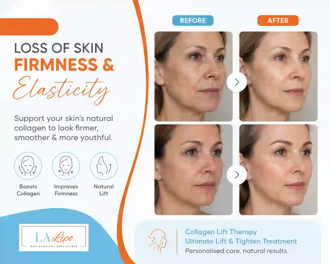 Sign #7: Loss of Skin Firmness and Elasticity Apsley
