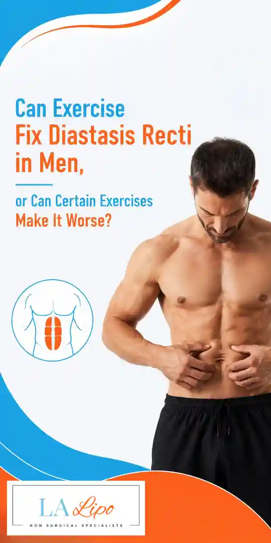 Can Exercise Fix Diastasis Recti in Men, or Can Certain Exercises Make It Worse Apsley?