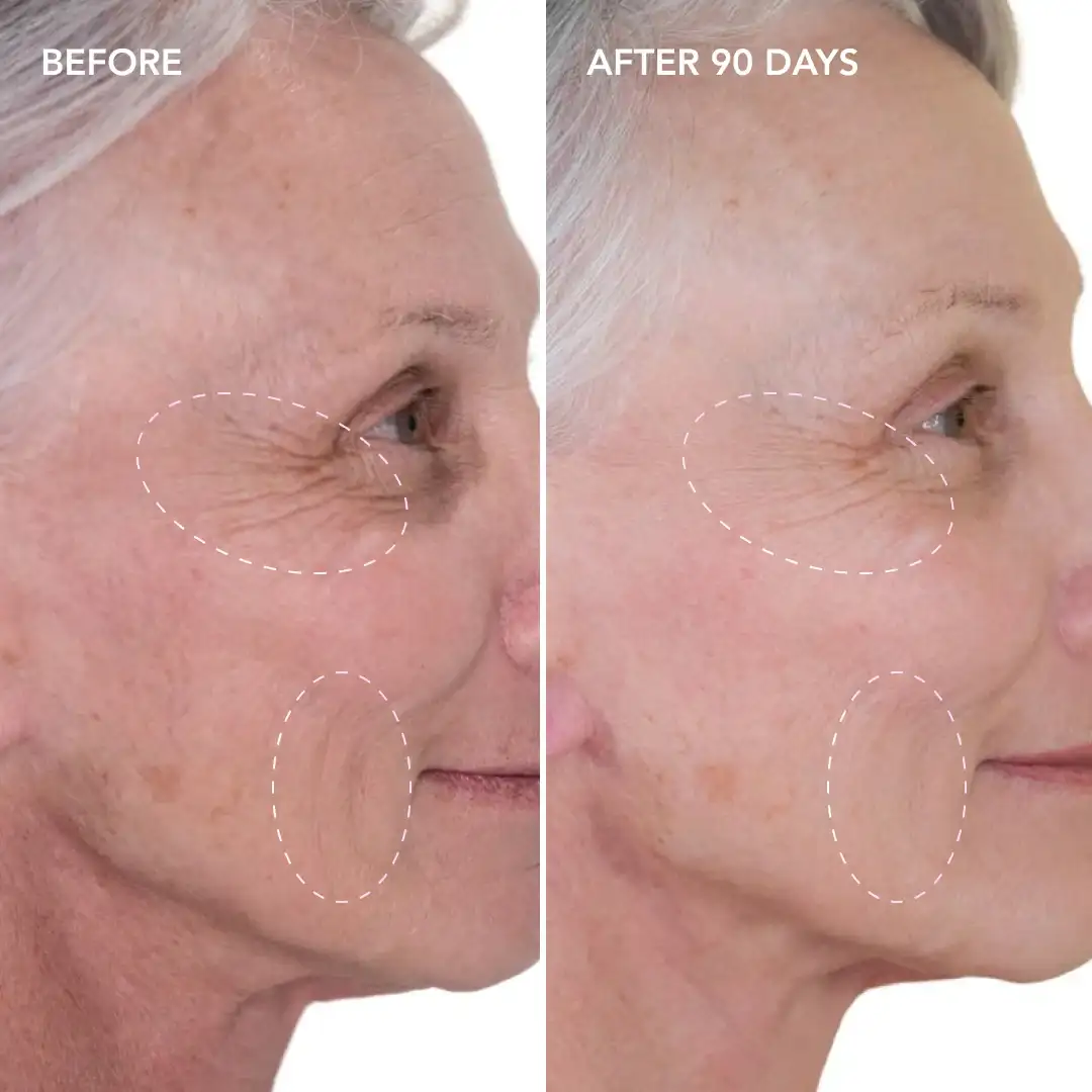 When will you see results Apsley